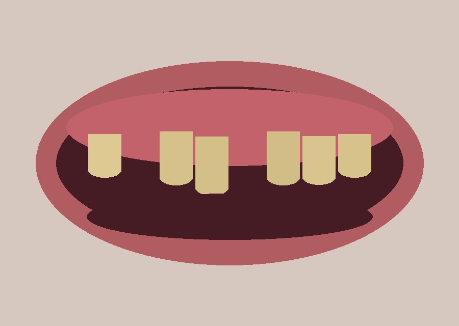 Aesthetics with zirconia crowns — Before