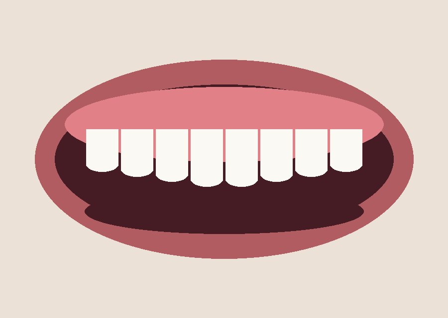 Bite correction with braces — After
