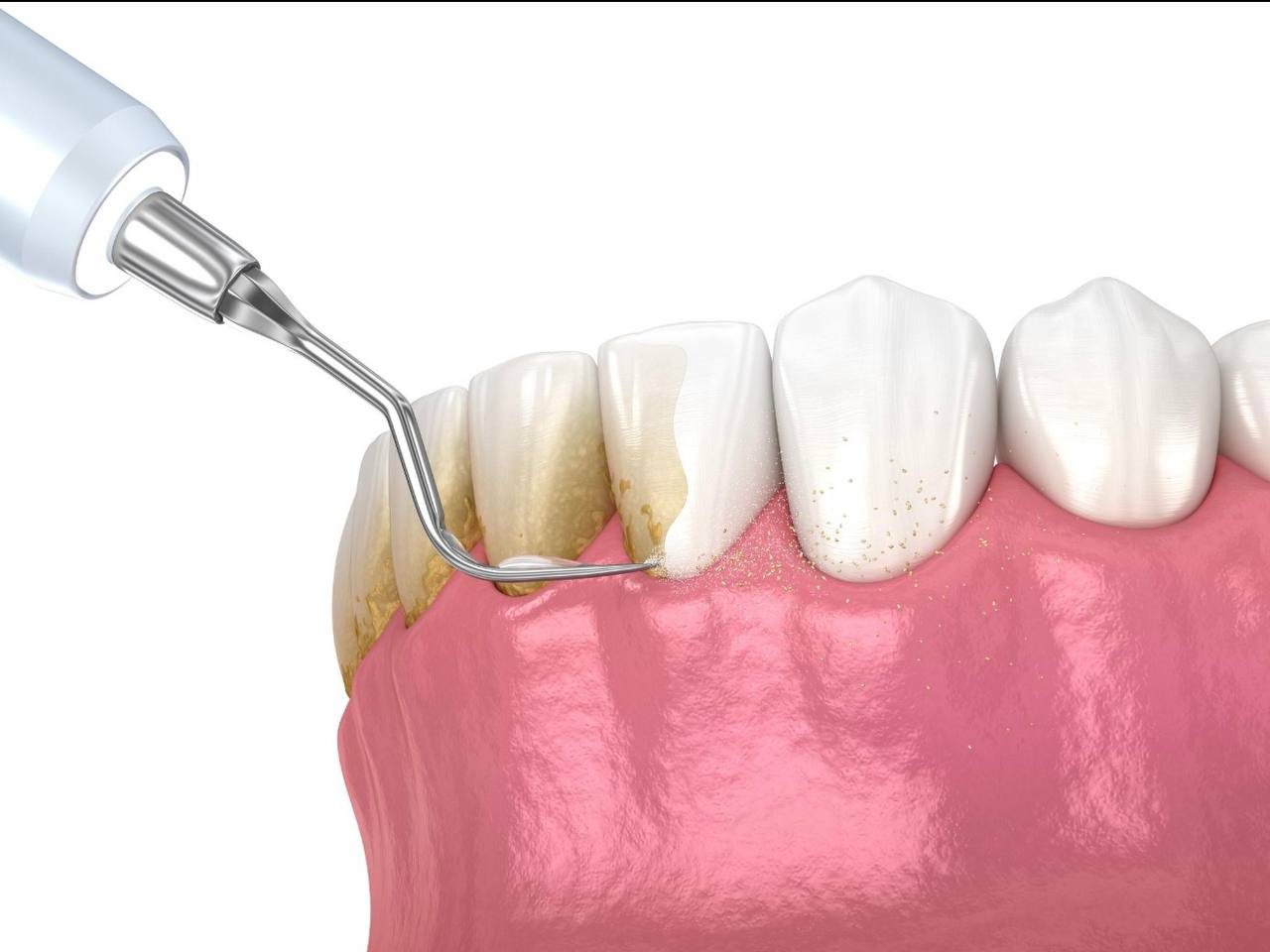 Periodontics & hygiene